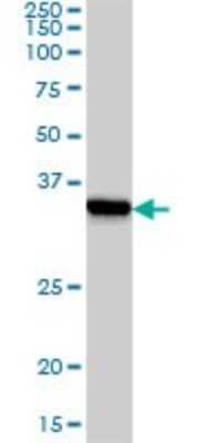 Western Blot: TRAP alpha Antibody (1C11) [H00006745-M02]