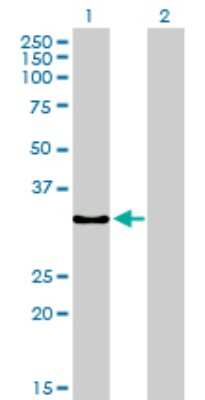 Western Blot: TRAP alpha Antibody (1C11) [H00006745-M02]