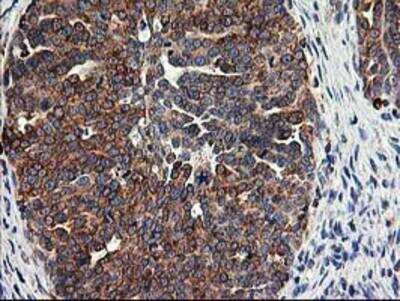 Immunohistochemistry-Paraffin: TRAP alpha Antibody (OTI4C7) [NBP2-01026]