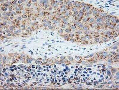 Immunohistochemistry-Paraffin: TRAP alpha Antibody (OTI4C7) [NBP2-01026]