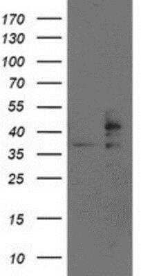 Western Blot: TRAP alpha Antibody (OTI4C7) [NBP2-01026]