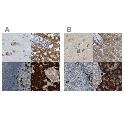 Immunohistochemistry-Paraffin: TRAP alpha Antibody [NBP1-86912]