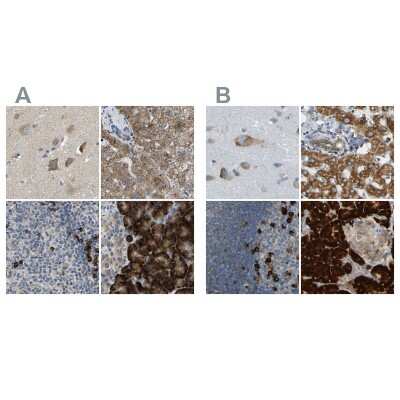 Immunohistochemistry-Paraffin: TRAP alpha Antibody [NBP1-87815]