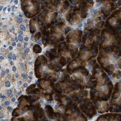 Immunohistochemistry-Paraffin: TRAP alpha Antibody [NBP1-87815]