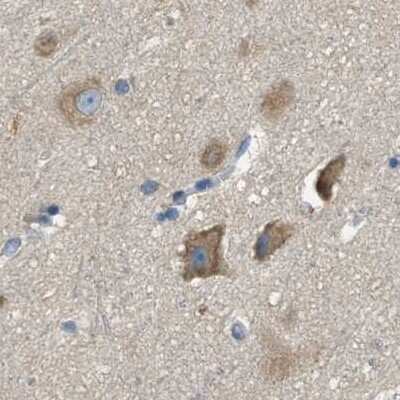 Immunohistochemistry-Paraffin: TRAP alpha Antibody [NBP1-87815]