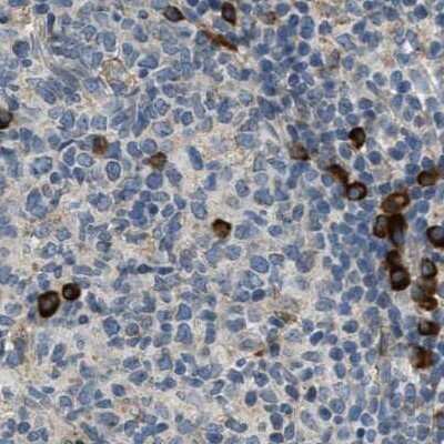 Immunohistochemistry-Paraffin: TRAP alpha Antibody [NBP1-87815]