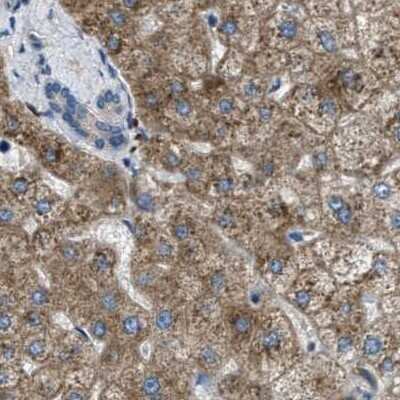 Immunohistochemistry-Paraffin: TRAP alpha Antibody [NBP1-87815]