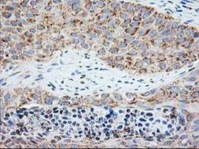Immunohistochemistry: TRAP alpha Antibody (OTI4C7) - Azide and BSA Free [NBP2-74591]