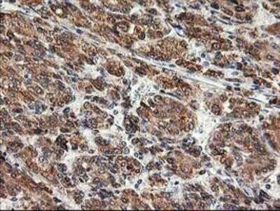 Immunohistochemistry: TRAP alpha Antibody (OTI4C7) - Azide and BSA Free [NBP2-74591]
