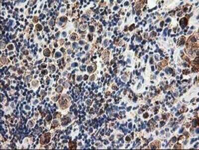 Immunohistochemistry: TRAP alpha Antibody (OTI4C7) - Azide and BSA Free [NBP2-74591]