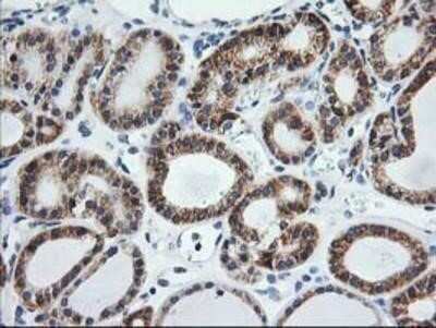 Immunohistochemistry: TRAP alpha Antibody (OTI4C7) - Azide and BSA Free [NBP2-74591]