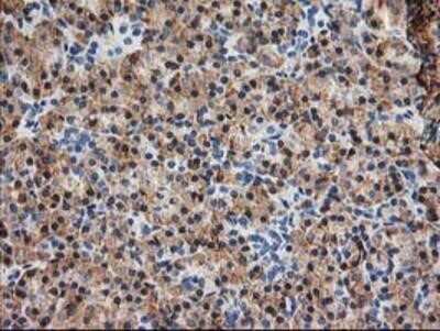 Immunohistochemistry: TRAP alpha Antibody (OTI4C7) - Azide and BSA Free [NBP2-74591]