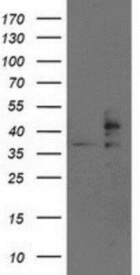 Western Blot: TRAP alpha Antibody (OTI4C7)Azide and BSA Free [NBP2-74591]