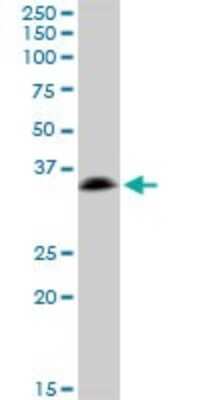 Western Blot: TRAP alpha Antibody [H00006745-B01P]