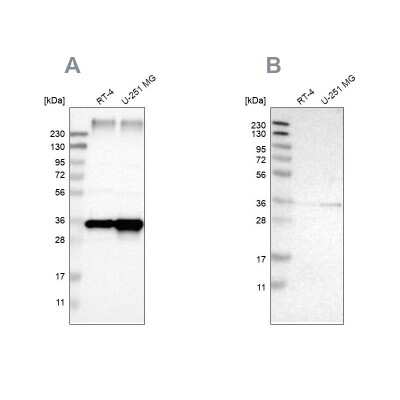 Western Blot: TRAP alpha Antibody [NBP1-86912]