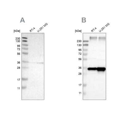 Western Blot: TRAP alpha Antibody [NBP1-87815]