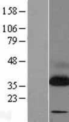 Western Blot: TRAP alpha Overexpression Lysate [NBL1-16473]