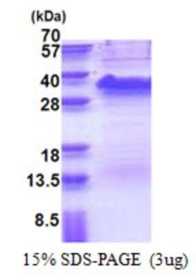 SDS-PAGE: Recombinant Human TRAP alpha His Protein [NBP2-51512]