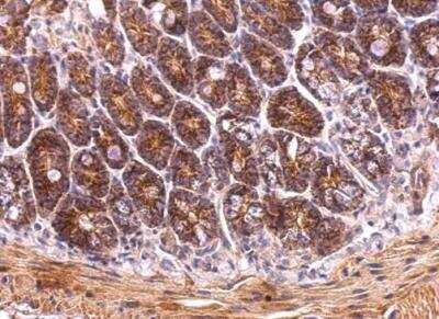 Immunohistochemistry-Paraffin: TRAP1 Antibody [NBP1-32097]