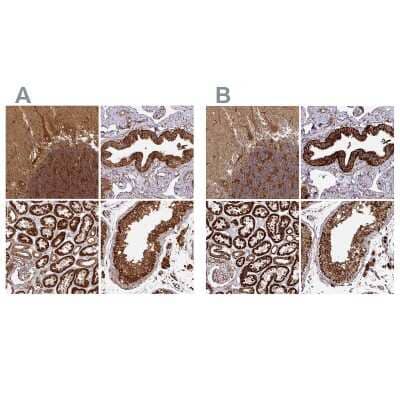 Immunohistochemistry-Paraffin: TRAP1 Antibody [NBP2-47597]