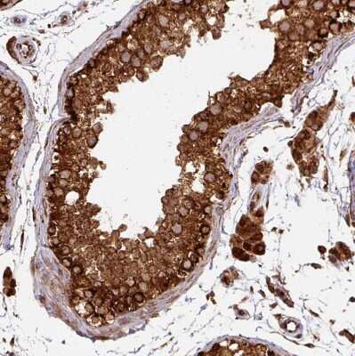 Immunohistochemistry-Paraffin: TRAP1 Antibody [NBP2-47597]