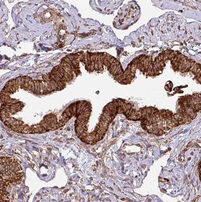 Immunohistochemistry-Paraffin: TRAP1 Antibody [NBP2-47597]