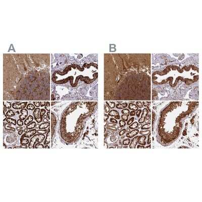 Immunohistochemistry-Paraffin: TRAP1 Antibody [NBP2-47598]