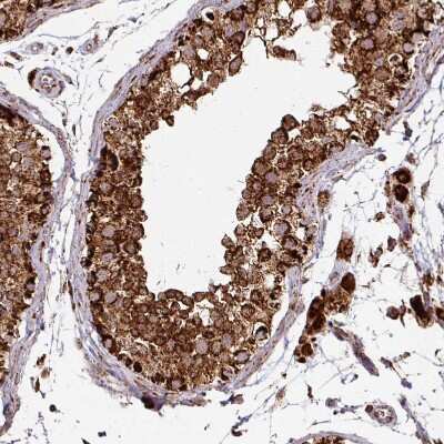 Immunohistochemistry-Paraffin: TRAP1 Antibody [NBP2-47598]