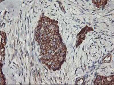 Immunohistochemistry: TRAP1 Antibody (OTI1H8) - Azide and BSA Free [NBP2-74592]