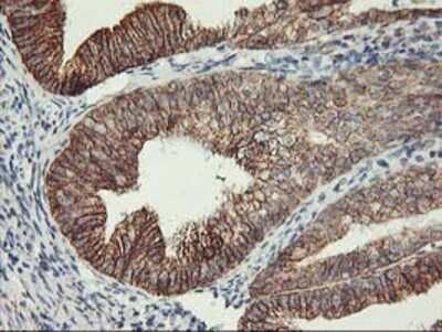 Immunohistochemistry: TRAP1 Antibody (OTI1H8) - Azide and BSA Free [NBP2-74592]