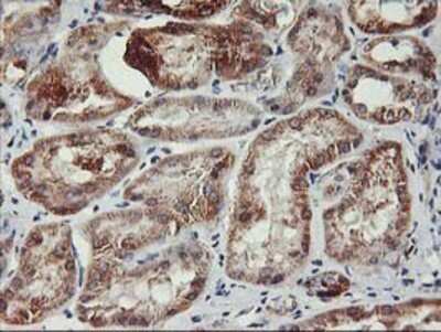 Immunohistochemistry: TRAP1 Antibody (OTI1H8) - Azide and BSA Free [NBP2-74592]