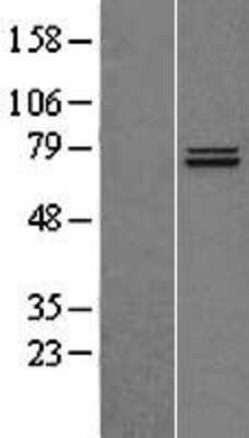 Western Blot: TRAP1 Overexpression Lysate [NBL1-17255]