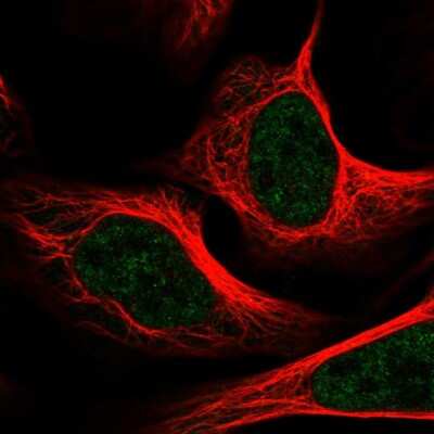 Immunocytochemistry/ Immunofluorescence: TRAP220/MED1 Antibody [NBP2-57045]