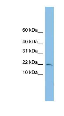 Western Blot: TRAPPC1 Antibody [NBP1-57715]