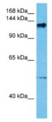 Western Blot: TRAPPC11 Antibody [NBP3-10060]