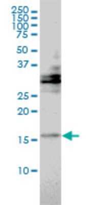 Western Blot: TRAPPC2 Antibody (2E10) [H00006399-M01]