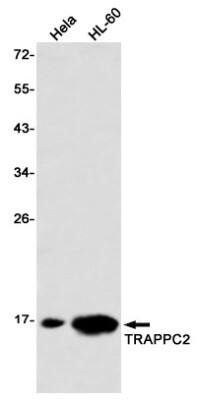 Western Blot: TRAPPC2 Antibody (S02-4G4) [NBP3-19923]