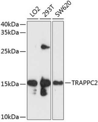 Western Blot: TRAPPC2 AntibodyBSA Free [NBP2-93565]