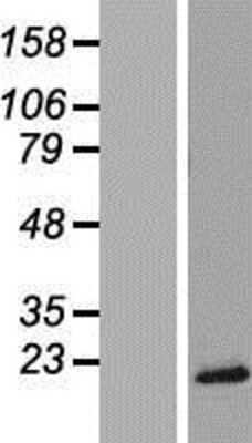 Western Blot: TRAPPC2 Overexpression Lysate [NBL1-17257]