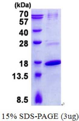 SDS-PAGE: Recombinant Human TRAPPC2 His Protein [NBP2-22875]