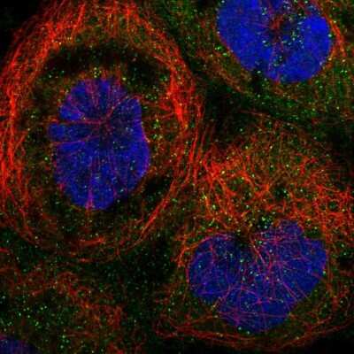 Immunocytochemistry/ Immunofluorescence: TRAPPC2L Antibody [NBP1-83172]