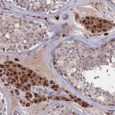 Immunohistochemistry-Paraffin: TRAPPC2L Antibody [NBP1-83172]