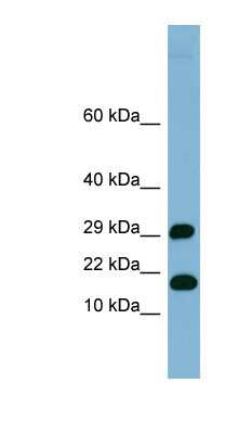 Western Blot: TRAPPC2L Antibody [NBP1-70735]