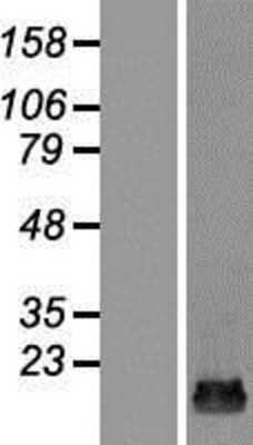 Western Blot: TRAPPC2L Overexpression Lysate [NBP2-07072]