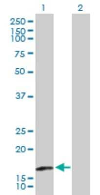 Western Blot: TRAPPC3 Antibody [H00027095-B01P]