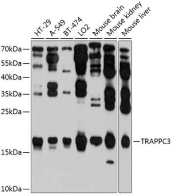 Western Blot: TRAPPC3 AntibodyBSA Free [NBP2-93057]