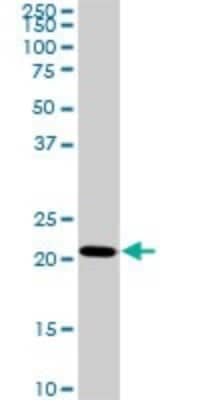 Western Blot: TRAPPC4 Antibody (2D10) [H00051399-M01]