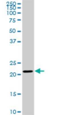 Western Blot: TRAPPC4 Antibody (2D10) [H00051399-M01]