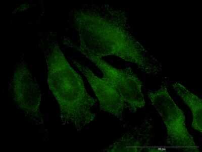 Immunocytochemistry/ Immunofluorescence: TRAPPC4 Antibody (2D5) [H00051399-M03]