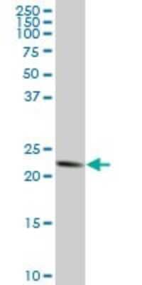 Western Blot: TRAPPC4 Antibody (2D5) [H00051399-M03]